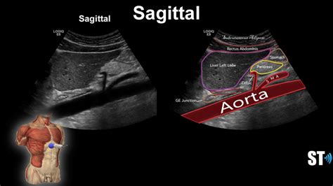 Liver Anatomy And Protocol Sonographic Tendencies