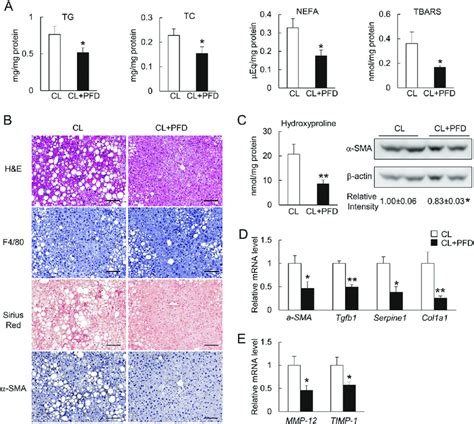 Pirfenidone Reversed Advanced Nash In Mice A Hepatic Tg Tc Nefa And