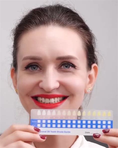 Épinglé Sur Teeth Whitening