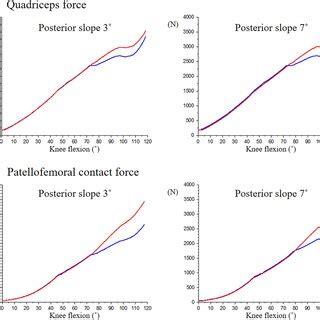 Patellofemoral Kinematics During Knee Flexion CR Cruciate Retaining