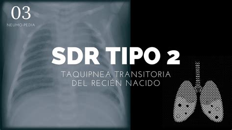 Taquipnea Transitoria Del Reci N Nacido Enarm Youtube