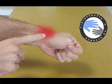 Tendinitis De Mu Eca O Quervain Estiramientos Para Aliviar El Dolor