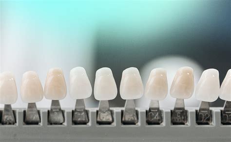 Teeth Veneers Pros And Cons