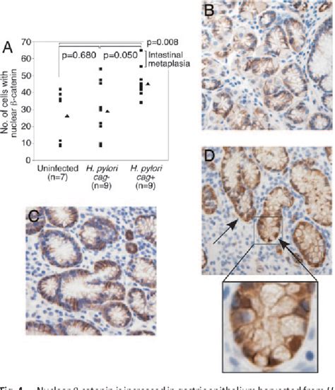 Figure From Activation Of Cid Catenin By Carcinogenic