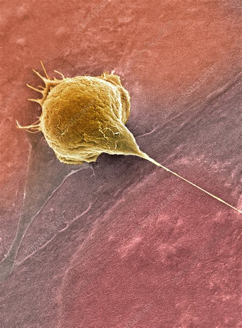 Bladder Cancer Cell SEM Stock Image M132 0948 Science Photo Library