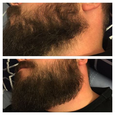 Before and after using world famous Lumberjack's beard oil | Beard oil ...