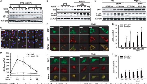 Figure 1 From Autophagy Controls P38 Activation To Promote Cell