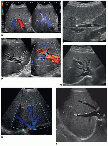 The Liver Radiology Key