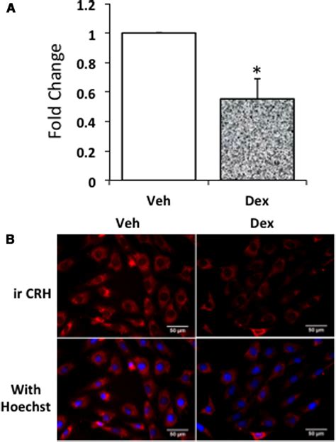 Dex Treatment Decreases The Expression Of Crh In Ivb Cells A Mrna