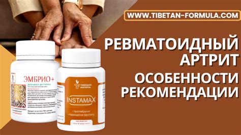 Ревматоидный артрит - особенности, рекомендации - YouTube