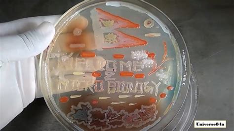 Microbial Art: Introduction, Requirements, Making Procedure, Uses