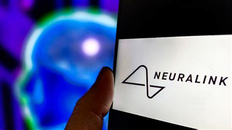 Elon Musk Says Neuralink Put Its Brain Implant Into A Human