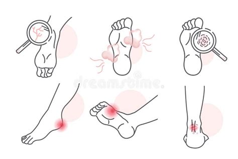 Stink Foot Stock Illustrations 118 Stink Foot Stock Illustrations