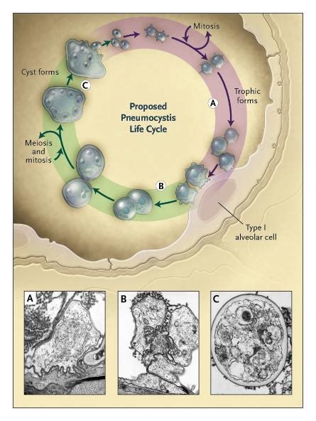 Pneumocystis Jiroveci