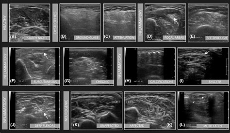 Ultrasound Of The Musculoskeletal System Anatomical Exploration And