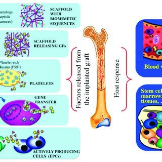 Scheme Showing Features From Implants At The Bone Defect Site That