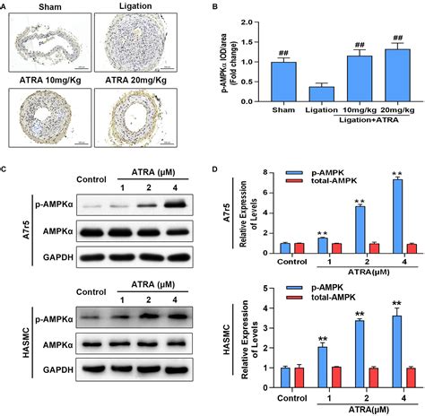 Frontiers All Trans Retinoic Acid Suppresses Neointimal Hyperplasia