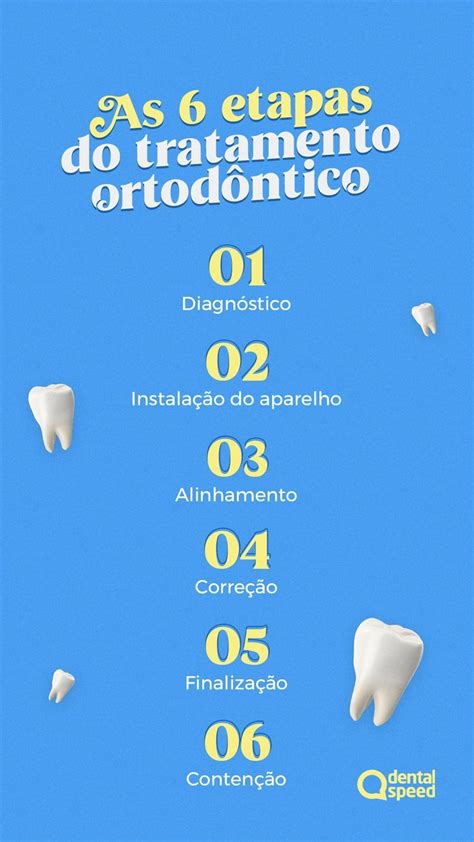 As 6 etapas do tratamento ortodôntico Tratamento ortodôntico