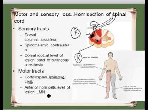 ipsilateral contralateral - YouTube