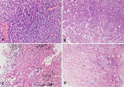 The histopathological images show periapical granuloma in tissues from ...