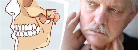 Craniomandibuläre Dysfunktion CMD Zahnspangenwelt Deine