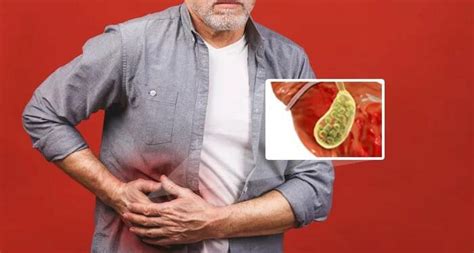 Management of Gallstones and How to Deal With It - Tfipost.com