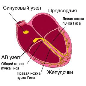 Мерцательная аритмия: причины, симптомы, класификация; прогнозы, чем ...