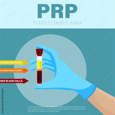 Vector Illustration Of Prp Poster With Text Place Hand Holding A Test