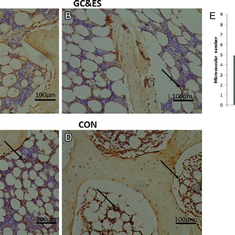 A E Cd Expression In The Femoral Head Of Rabbits In The Gc Group