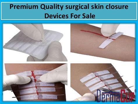 Purchase Premium Quality Wound Closure Devices At Reasonable Prices