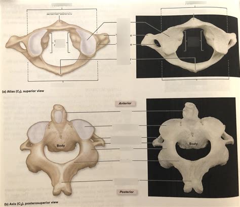 Week 3 C1 And C2 Vertebrae Structure Diagram Diagram Quizlet