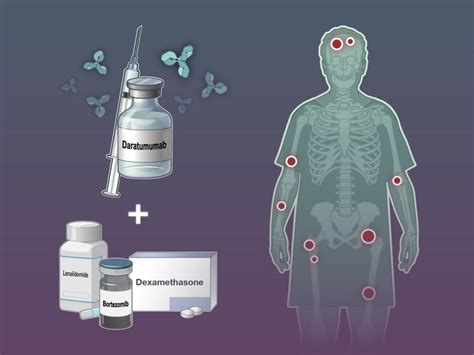 Daratumumab Bortezomib Lenalidomide And Dexamethasone For Multiple