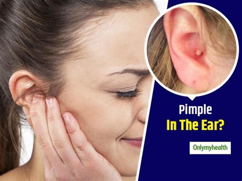 Annoying Pimple Inside The Ear Know 9 Home Remedies To Get Rid Of It Healthydailytips