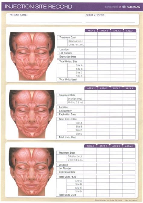 Printable Botox Charting Sheet