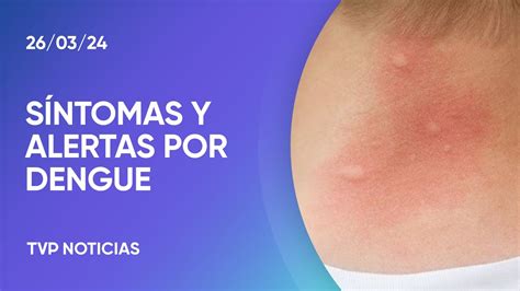 Alerta Por Casos De Dengue Y Recomendaciones Ante S Ntomas En Ni Os Y