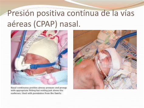 Ppt T Cnicas De Administraci N De Ox Geno En El Neonato Powerpoint