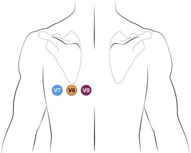 PR16: 12-Lead ECG Acquisition