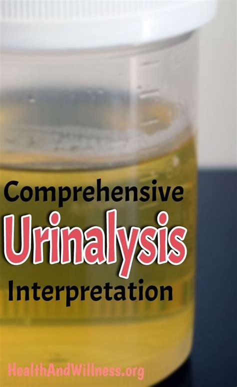 Comprehensive Urine Analysis Interpretation For Medical Professionals Health And Willness