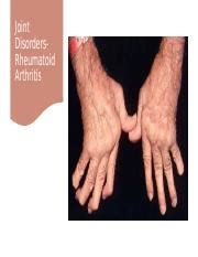 Rheumatoid Arthritis Lecture Slides Pptx Joint Disordersrheumatoid