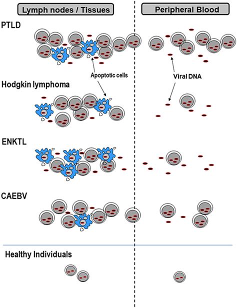 Frontiers Ebv Viral Loads In Diagnosis Monitoring And Response