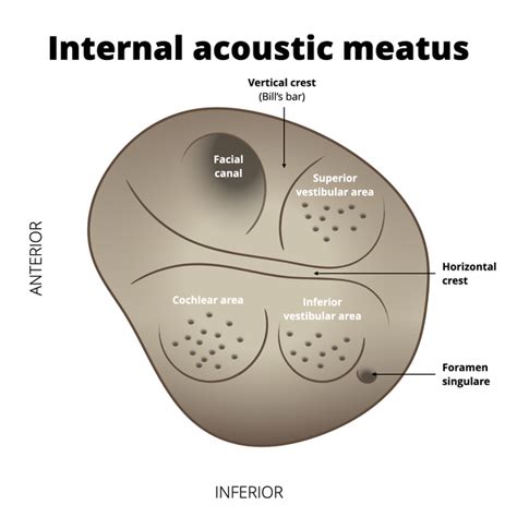 Internal Acoustic Meatus CPA And Internal Acoustic Meatus 