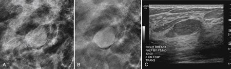 Mammographic And Ultrasound Analysis Of Breast Masses Clinical Tree