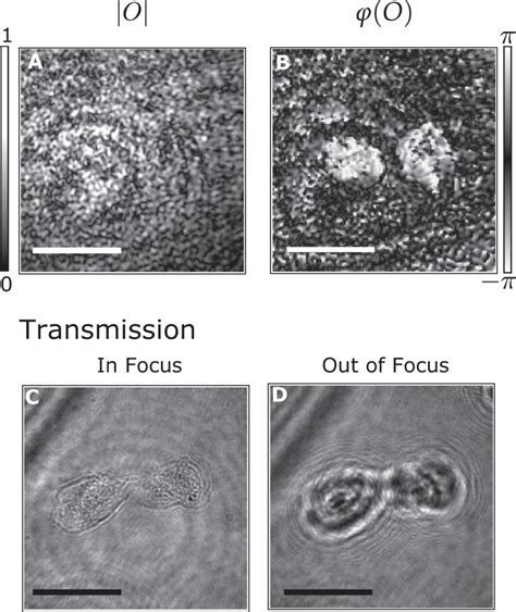 Phase Contrast Imaging A B Reconstructed Image Of Two Cheek Cells Download Scientific