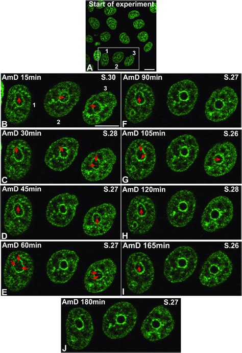 The Dynamics Of Histone H2b Gfp During Inhibition Of Rrna Synthesis In