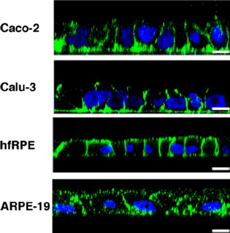 Adenovirus Infection Of Polarized Epithelial Monolayers Confluent