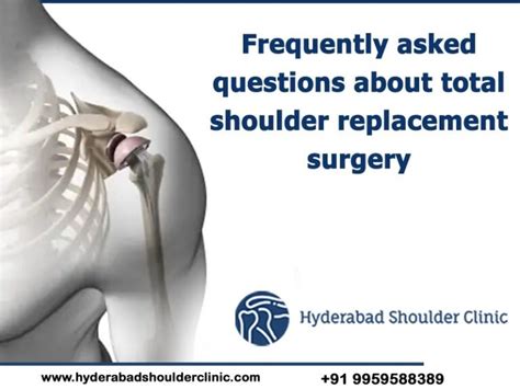 Frequently Asked Questions About Total Shoulder Replacement Surgery Shoulder Clinic Hyderabad