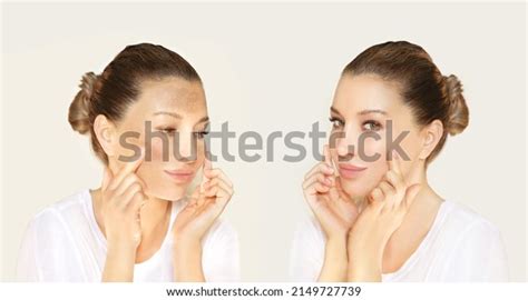 3,421 Chloasma Royalty-Free Photos and Stock Images | Shutterstock