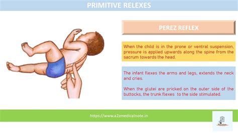 Perez Reflex How To Apply Medical Infant