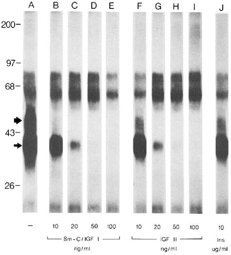 Figure 1 From Rat Astroglial Somatomedin Insulin Like Growth Factor