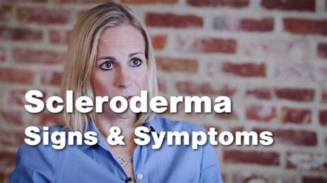 Signs And Symptoms Of Scleroderma Johns Hopkins Rheumatology